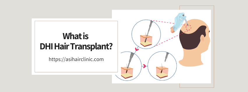 What is DHI Hair Transplant?