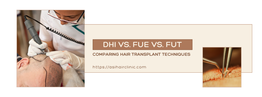 DHI vs. FUE vs. FUT: Comparing Hair Transplant Techniques