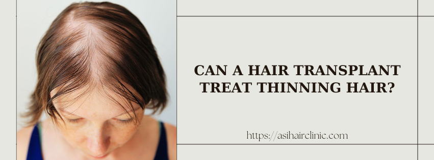 Can A Hair Transplant Treat Thinning Hair?