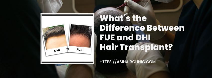 What's the Difference Between FUE and DHI Hair Transplant?