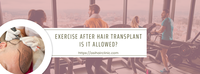 Exercise After Hair Transplant - Is It Allowed?