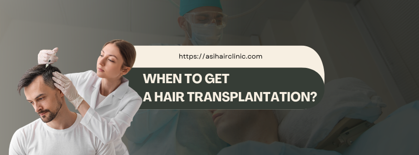 When to Get a Hair Transplantation?