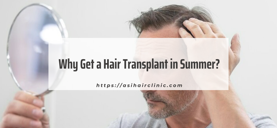 Why Get a Hair Transplant in Summer?