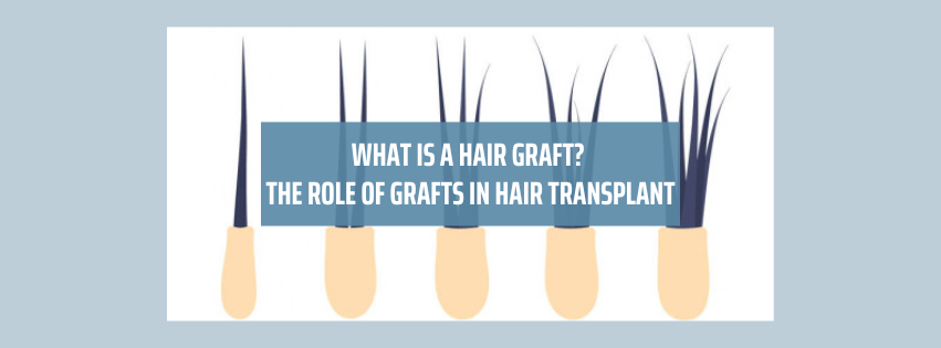 What Is A Hair Graft? The Role Of Grafts In Hair Transplant