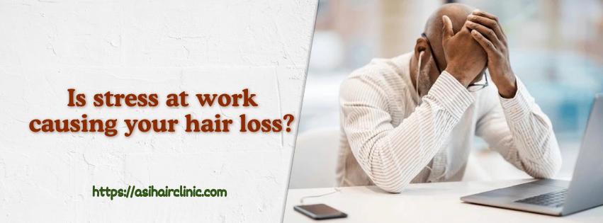 Is stress at work causing your hair loss?