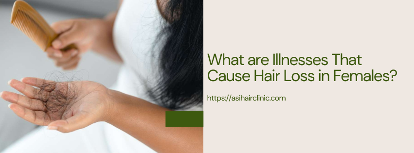 What are Illnesses That Cause Hair Loss in Females?