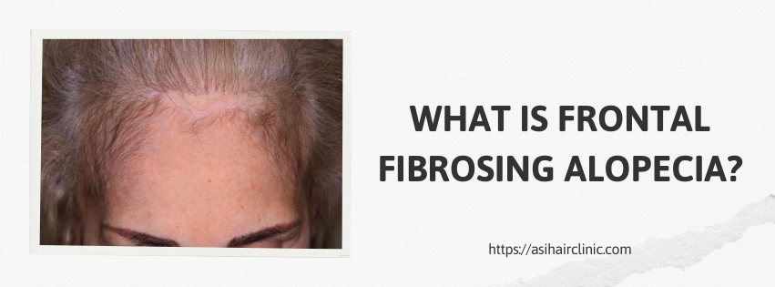 What is Frontal Fibrosing Alopecia?