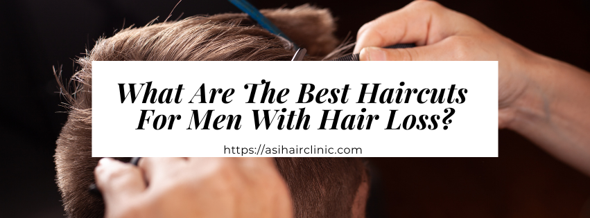 What Are The Best Haircuts For Men With Hair Loss?