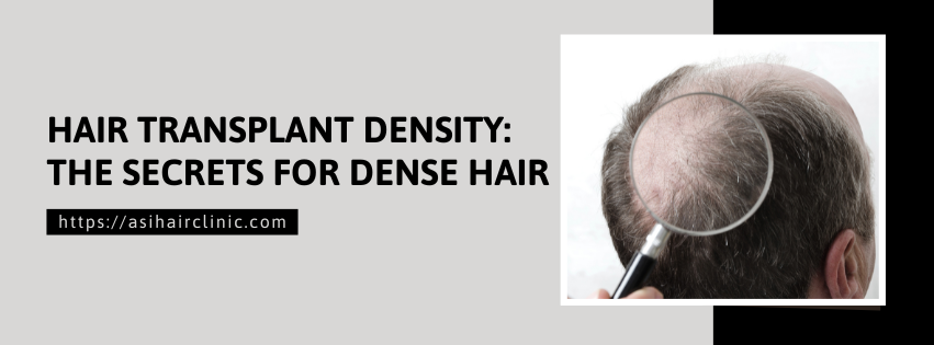Hair Transplant Density: The Secrets for Dense Hair