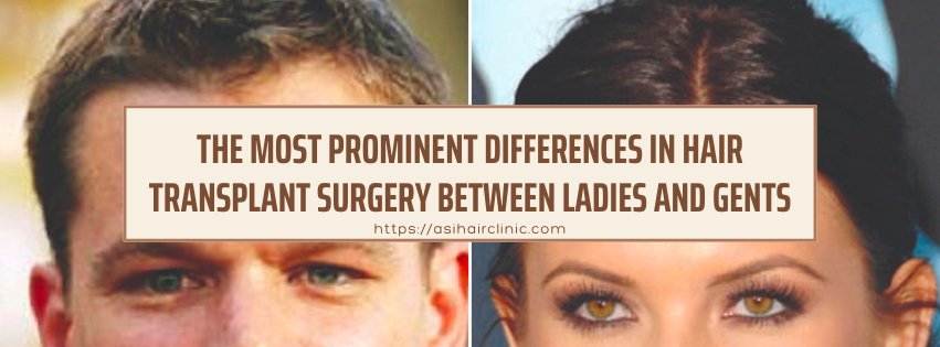 The Most Prominent Differences In Hair Transplant Surgery Between Ladies and Gents