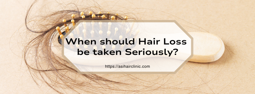 When should Hair Loss be taken Seriously?