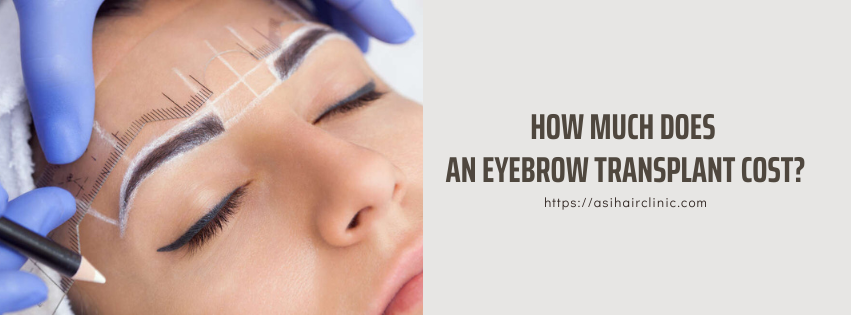 How Much Does An Eyebrow Transplant Cost?