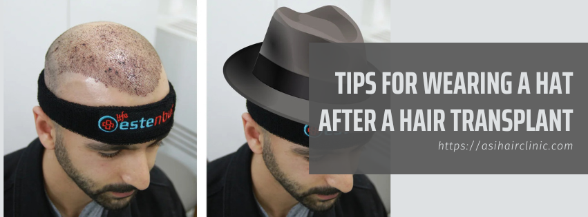 Tips for Wearing a Hat After a Hair Transplant