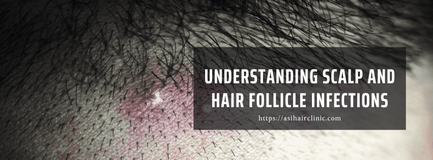 Understanding Scalp and Hair Follicle Infections: Causes, Symptoms, and Treatments