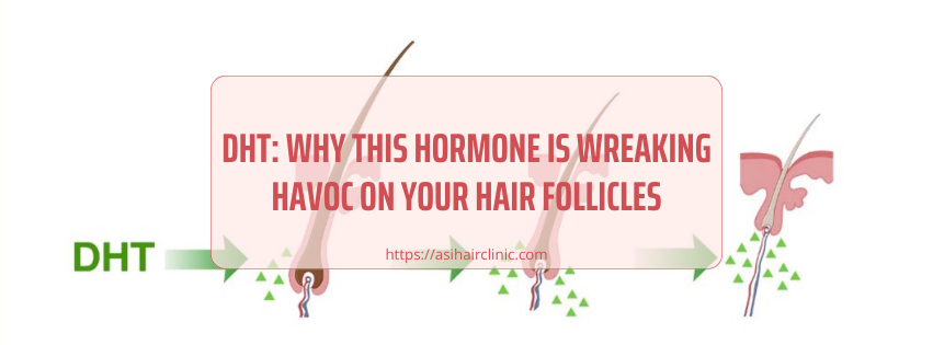 DHT: Why This Hormone Is Wreaking Havoc on Your Hair Follicles