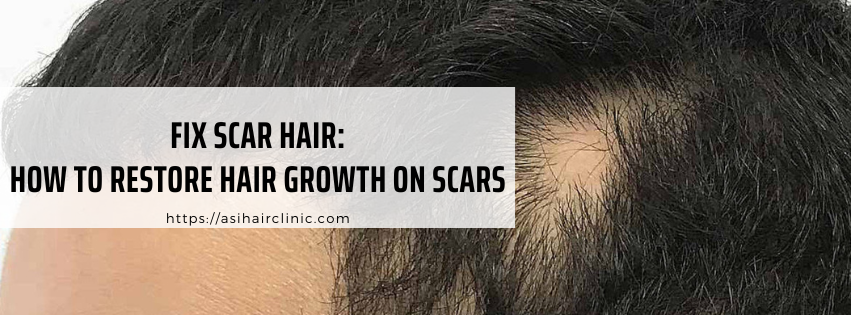 Fix Scar Hair: How to Restore Hair Growth on Scars