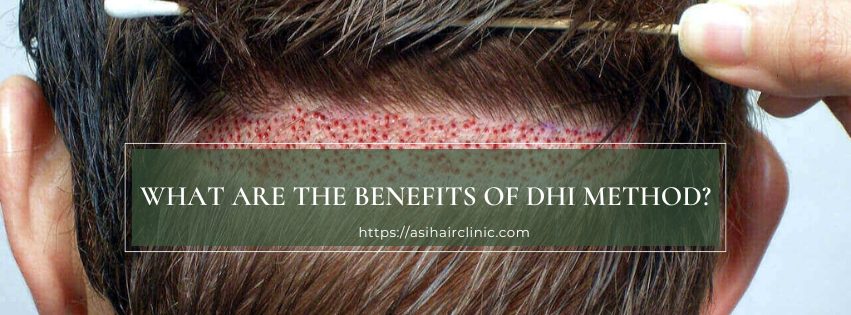 What are the benefits of DHI method?