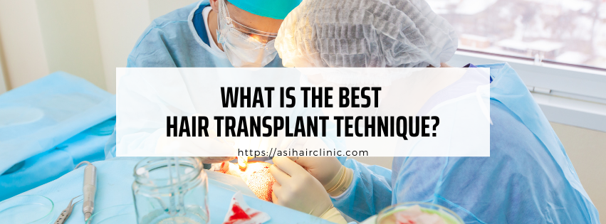 What Is the Best Hair Transplant Technique?