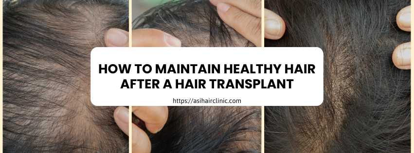 How to Maintain Healthy Hair After a Hair Transplant