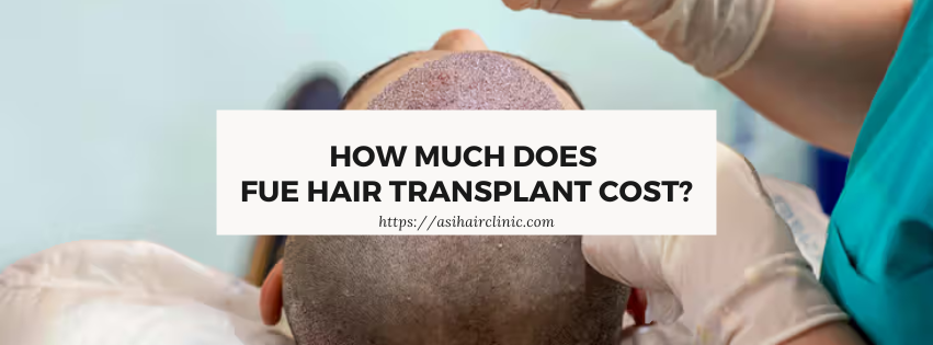 How much does FUE Hair Transplant Cost? (2024)