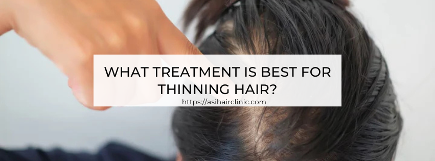 What treatment is best for thinning hair?
