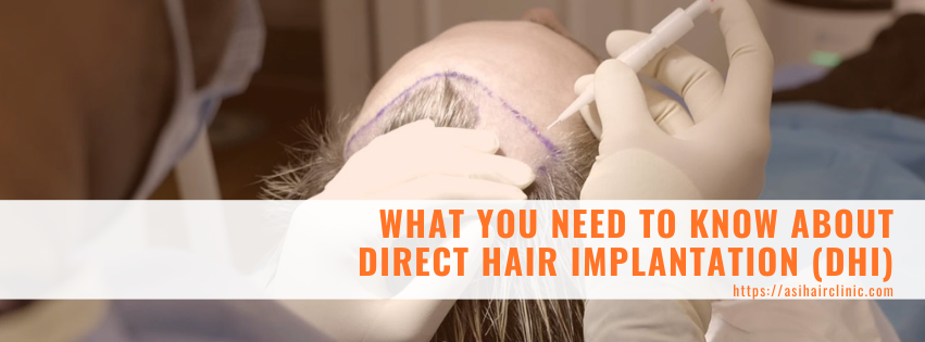 What You Need to Know About Direct Hair Implantation (DHI)