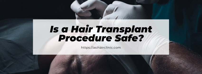 Is a Hair Transplant Procedure Safe?