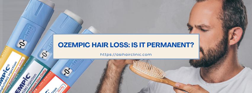 Ozempic Hair Loss: Is It Permanent?