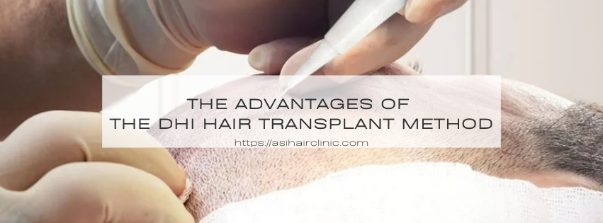 The Advantages of the DHI Hair Transplant Method