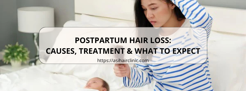 Postpartum Hair Loss: Causes, Treatment & What to Expect