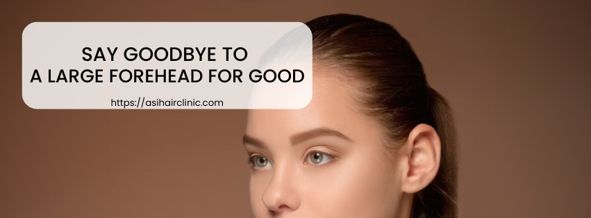 Say Goodbye to a Large Forehead for Good