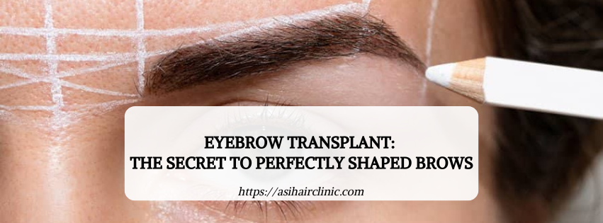 Eyebrow Transplant: The Secret to Perfectly Shaped Brows