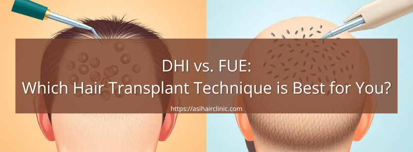 DHI vs. FUE: Which Hair Transplant Technique is Best for You?