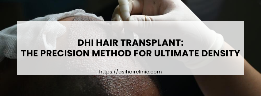 DHI Hair Transplant: The Precision Method for Ultimate Density