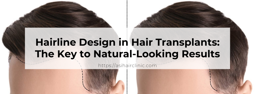 Hairline Design in Hair Transplants: The Key to Natural-Looking Results