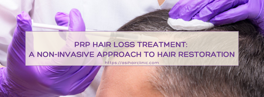 PRP Hair Loss Treatment: A Non-Invasive Approach to Hair Restoration