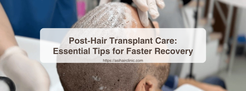 Post-Hair Transplant Care: Essential Tips for Faster Recovery