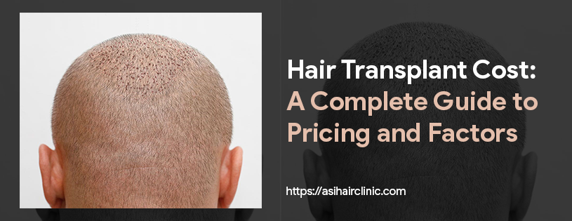 Hair Transplant Cost: A Complete Guide to Pricing and Factors