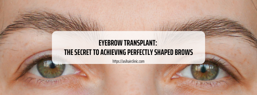 Eyebrow Transplant: The Secret to Achieving Perfectly Shaped Brows