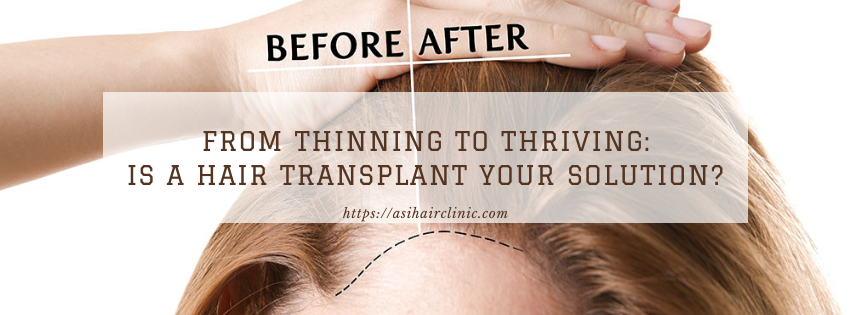 From Thinning to Thriving: Is a Hair Transplant Your Solution?