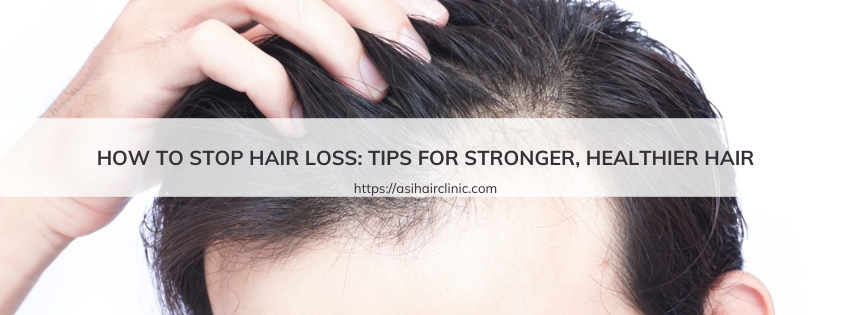 How to Stop Hair Loss: Tips for Stronger, Healthier Hair