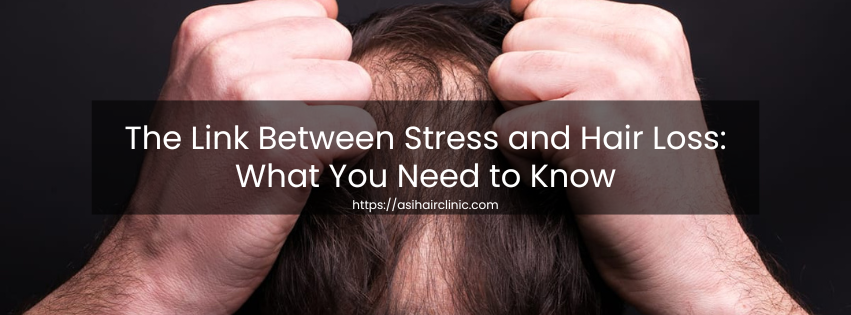 The Link Between Stress and Hair Loss: What You Need to Know