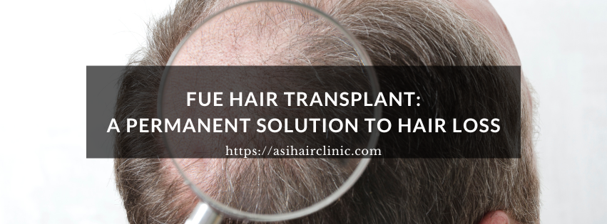 FUE Hair Transplant: A Permanent Solution to Hair Loss