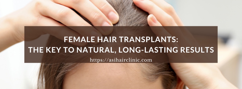 Female Hair Transplants: The Key to Natural, Long-Lasting Results