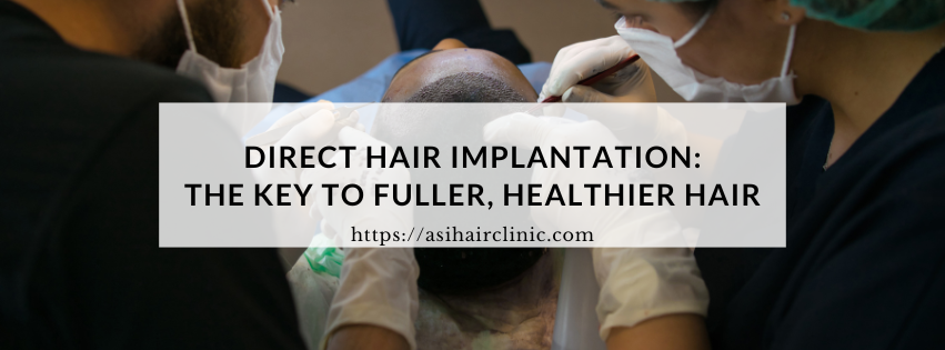 Direct Hair Implantation: The Key to Fuller, Healthier Hair