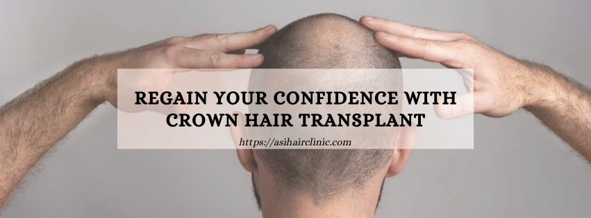 Regain Your Confidence with Crown Hair Transplant