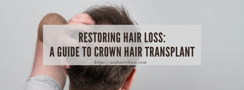 Restoring Hair Loss: A Guide to Crown Hair Transplant