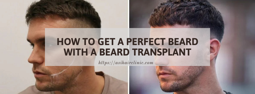 How to Get a Perfect Beard with a Beard Transplant