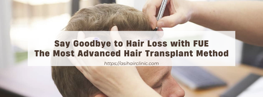 Say Goodbye to Hair Loss with FUE - The Most Advanced Hair Transplant Method!
