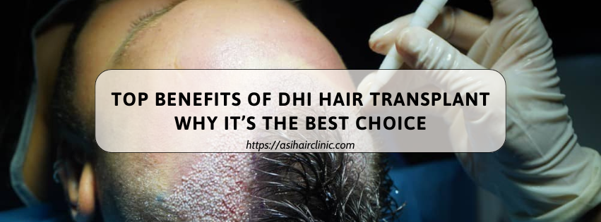 Top Benefits of DHI Hair Transplant: Why It’s the Best Choice